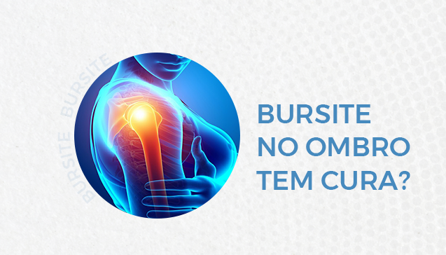 Bursite no ombro tem cura?