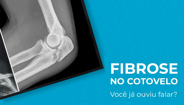 Fibrose no cotovelo