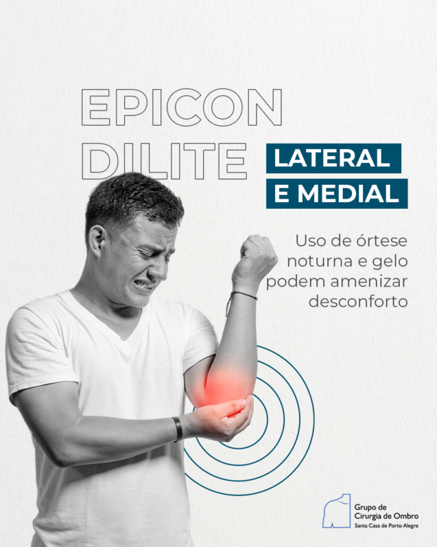 Epicondilite lateral e medial