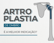 Artroplastia de ombro: é a melhor indicação?