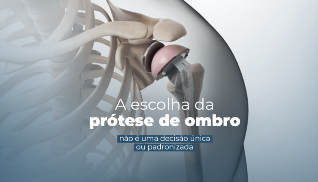 Fatores que influenciam na escolha da prótese de ombro.