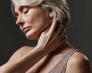 Osteoporose após a menopausa